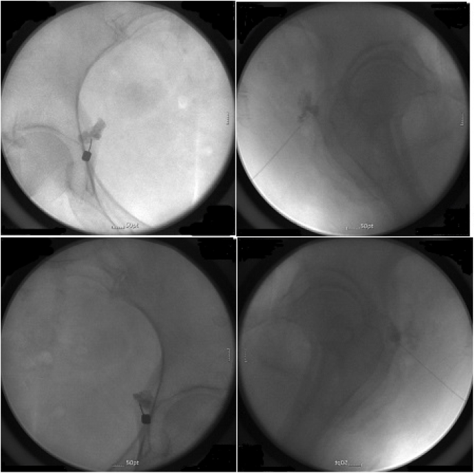 Fig. 1