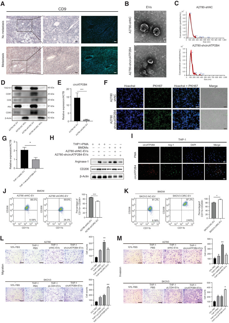 Figure 3. EVs-packaged circATP2B4 induces the polarization of M2 macrophages to promote the migration, invasion, and EMT of ovarian cancer cells. A, Expression of CD9 was examined by IHC and IF in EOC non-metastatic and metastatic tissue section (magnification, ×100 and ×200). Scale bars, 50 μmol/L. B, Electron microscopy images of EVs isolated from conditioned medium of A2780-shNC and A2780-shcircATP2B4. Scale bars, 100 nm. C, NTA analysis of EVs isolated from A2780-shNC and A2780-shcircATP2B4 cell culture supernatants. D, Western blot analysis for EVs marker proteins CD63, ALIX, CD9, CD81, and TSG101, whole cell lysate protein as control. E, The expression of circATP2B4 in EVs extracted from A2780-shNC and A2780-shcircATP2B4 were detected by qRT-PCR. F, Representative IF image shows the internalization of PKH67-labeled A2780-derived EVs (green) by macrophages. Scale bars, 100 μmol/L. G, qRT-PCR detection of A2780-shNC and A2780-shcircATP2B4 EVs added to macrophages for 24 hours, the expression of circATP2B4 in macrophages. H, Western blotting analysis was used to detect M2 marker Arginase-1 and CD206 of Macrophages (THP-1+PMA and BMDMs), expression was normalized to β-actin. I, FISH-IF detected the RNA and arginase-1 protein expression of circATP2B4 in macrophages (THP-1+PMA) after adding A2780-EVs. Scale bars, 20 μmol/L. J and K, FCM analysis macrophages (BMDMs) treated with EVs from A2780 (A2780-shNC and A2780-shcircATP2B4) or SKOV3 (SKOV3-NC and SKOV3-circATP2B4), M2 macrophages (CD11b+ and CD206+). L, Migration capacity of A2780 (10%FBS, THP-1+PBS, THP-1+shNC-EVs, THP-1+shcircATP2B4-EVs) and SKOV3 (10%FBS, THP-1+PBS, THP-1+pLCDH-EVs, THP-1+circATP2B4-EVs) after coculture with macrophages, by the in vitro transwell coculture system without Matrigel are shown. Scale bars, 300 μmol/L. M, Invasion capacity of A2780 (10%FBS, THP-1+PBS, THP-1+shNC-EVs, THP-1+shcircATP2B4-EVs) and SKOV3 (10%FBS, THP-1+PBS, THP-1+pLCDH-EVs, THP-1+circATP2B4-EVs) after coculture with macrophages, by the in vitro transwell coculture system with Matrigel are shown. Scale bars, 300 μmol/L. Data are shown as mean ± SD of three independent experiments. *, P < 0.05; **, P < 0.01; ***, P < 0.001; n.s. not significant.