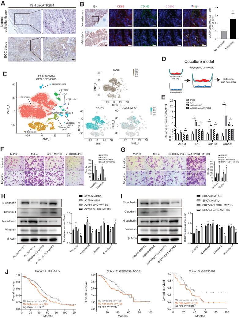 Figure 2. The correlation of circATP2B4 and M2 macrophages affects ovarian cancer progression. A, Expression of circATP2B4 was examined by ISH in normal ovarian epithelial tissues and EOC tissues. Scale bars, 50 μmol/L. B, ISH and multiplex fluorescent IHC of EOC nonmetastatic and metastatic tissue sections, DAB-circATP2B4, blue-DAPI, red-CD68, green-CD163, pink-CD206, representative images and IF with quantification. Scale bars, 20 μmol/L. C, TSNE plot showed the clusters of scRNA-seq in the ovarian cancer peritoneal metastasis samples from PRJNA609094 (GEO:GSE146026). Each dot is a cell colored by its analyzed cell types. D, Schematic illustration of the in vitro indirect coculture system. E, Macrophages (THP-1 with PMA) were cocultured with A2780-siNC or A2780-sicircATP2B4, or treated with control (PBS and IL4). After 48 hours, qRT-PCR was applied using primers for M2 markers (ARG1, IL10, CD163, CD206). The group treated with IL4 was used as positive control. F, Migration and invasion capacity of A2780 cocultured with macrophages (M, THP-1 with PMA) cocultured with A2780-siNC or A2780-sicircATP2B4, or treated with control (PBS and IL4) by the in vitro transwell coculture system. Scale bars, 300 μmol/L. G, Migration and invasion capacity of SKOV3 cocultured with macrophages (M, THP-1 with PMA) cocultured with SKOV3-pLCDH or SKOV3-circATP2B4, or treated with control (PBS and IL4) by the in vitro transwell coculture system. Representative photographs of migratory or invaded cells on the membrane coated with or without Matrigel (magnification, ×100) are shown. Scale bars, 300 μmol/L. H, The effect of the supernatants of macrophages cocultured with A2780-siNC or A2780-sicircATP2B4, or treated with control (PBS and IL4) on the EMT of A2780 was analyzed by Western blot analysis (*, P < 0.05). I, The effect of the supernatants of macrophages cocultured with SKOV3-pLCDH or SKOV3-circATP2B4, or treated with control (PBS and IL4) on the EMT of SKOV3 was analyzed by Western blot analysis. Densitometry shows relative protein expression normalized for β-actin. Data are representative of three independent experiments (*, P < 0.05). J, Kaplan–Meier survival curves in human ovarian cancer according to M2 macrophages infiltration abundance in TCGA-OV, AOCS, and GSE30161 data sets, (*, log-rank P < 0.05).