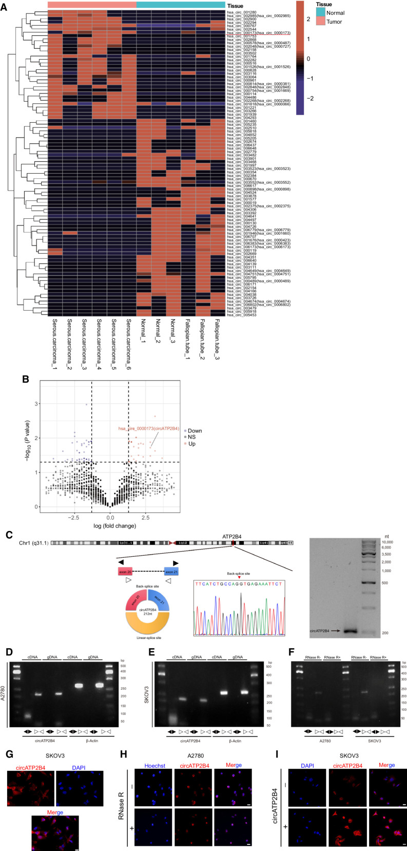 Figure 1. CircRNA expression profiles in EOC and characterization of circATP2B4. A, Hierarchical clustering of circRNA differential expression profiles between 6 EOC samples and 6 normal samples. The heat map was generated from differentially expressed circRNAs. B, Volcano map of deferentially expressed circRNAs. C, Schematic illustration of the genomic location and back splicing of circATP2B4 with the splicing site validated by Sanger sequencing and Northern blotting detection results of circATP2B4. D, Combining PCR with an electrophoresis assay indicated the presence of circATP2B4 using divergent and convergent primers from cDNA or genomic DNA (gDNA) in A2780 cells. E, Combining PCR with an electrophoresis assay indicated the presence of circATP2B4 using divergent and convergent primers from cDNA or gDNA in SKOV3 cells. F, The expression of circATP2B4 and ATP2B4 mRNA in both A2780 and SKOV3 cell lines was detected by PCR assay followed by nucleic acid electrophoresis in the presence or absence of RNase R. G, FISH analysis showed that circATP2B4 was mainly localized in the cytoplasm and a small part in the nucleus. Nucleus were stained blue with DAPI and cytoplasmic circATP2B4 was stained Cy3 (red). Scale bars, 20 μmol/L. H, RNA FISH analysis revealed the cellular localization of circATP2B4 in EOC cells when cells were treated with RNase R. Scale bars, 20 μmol/L. I, RNA FISH analysis revealed the expression of circATP2B4 in SKOV3 cells when cells were transfection of circATP2B4 plasmid. Scale bars, 20 μmol/L. The symbols * and ** show P < 0.05 and 0.01, respectively.