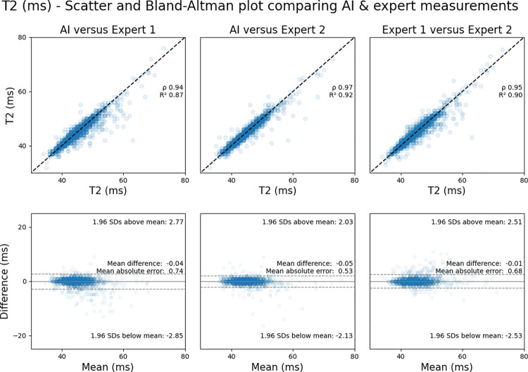 Agreement between expert-measured segment-wise T2 values across the testing dataset and those measured by artificial intelligence (AI). Scatterplots (top row) show comparisons between the AI solution and the expert who trained the network (expert 1) (left), the AI solution and the independent expert not involved in network training (expert 2) (middle), and the two experts (right). The corresponding Bland-Altman plots (bottom row) show the comparisons with 95% limits of agreement (dotted lines).