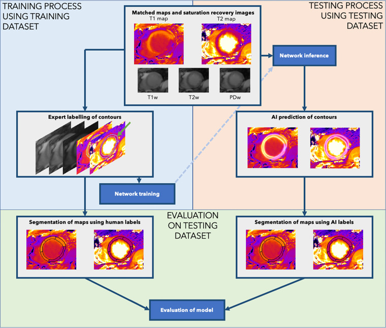 Data processing in the study. Human experts performed labeling of the endocardial and epicardial contours using the joint T1 and T2 maps (green arrow). The neural network was then trained using labeled contours from the training dataset (upper left: Training). The trained model was applied to the test image to output the heatmaps of myocardial boundary probabilities, from which the endocardial and epicardial contours were extracted (upper right: Testing). Finally, we evaluated the performance of the system by using the human-labeled and artificial intelligence (AI)–predicted contours for each testing set case to predict segment-wise T1 and T2 mapping values (bottom: Evaluation). PDw = proton density–weighted image, T1w = T1-weighted saturation-recovery image, T2w = T2-weighted image.