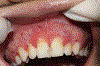 Figure 11.