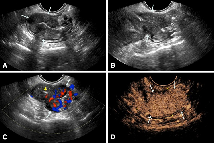 Fig. 9