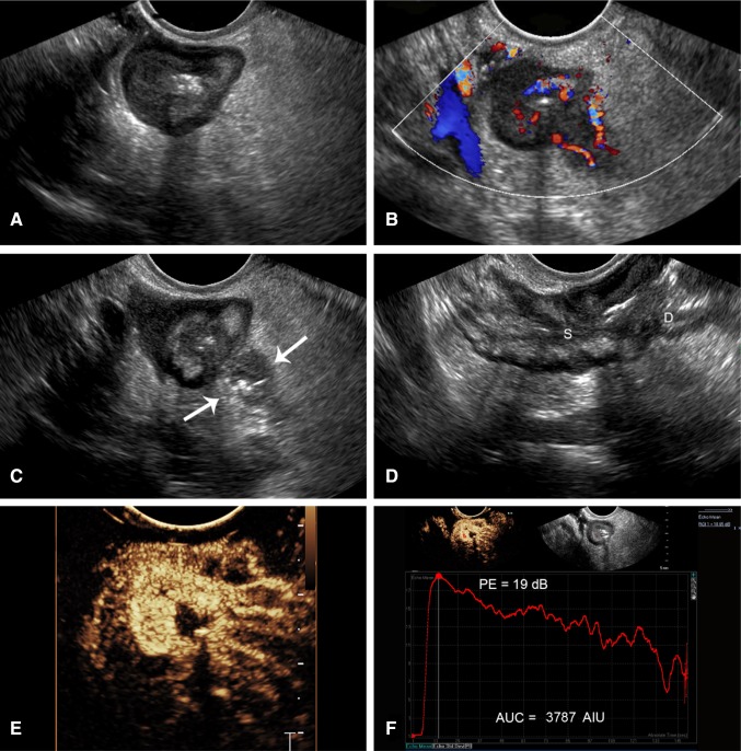 Fig. 2