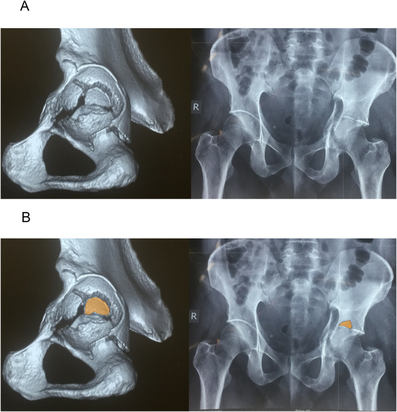 Fig. 1