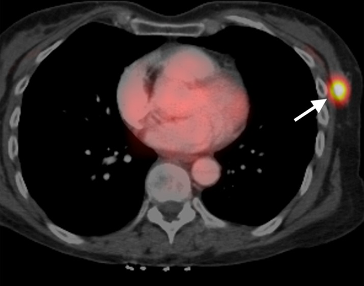 Figure 1b: