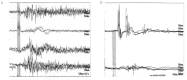 Figure 1. a, b