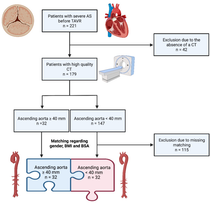 The presence of ascending aortic dilatation in patients undergoing