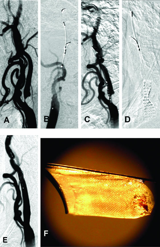 FIG. 6.