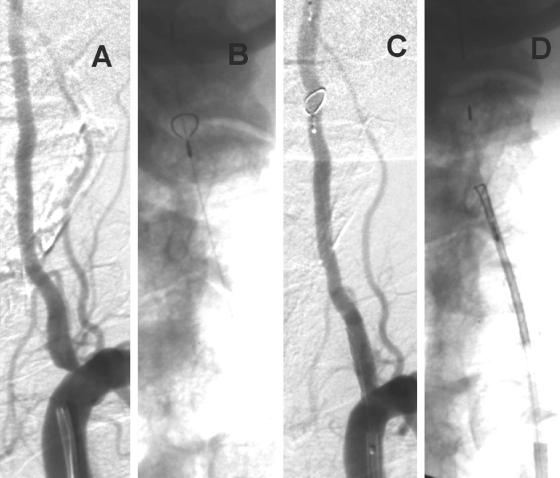 FIG. 5.