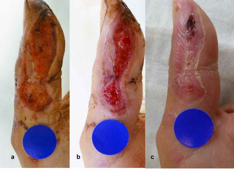 Figure 3.
