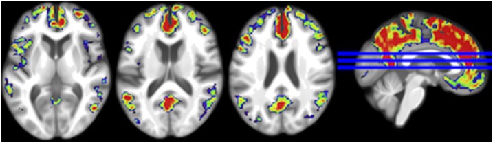 FIGURE 3