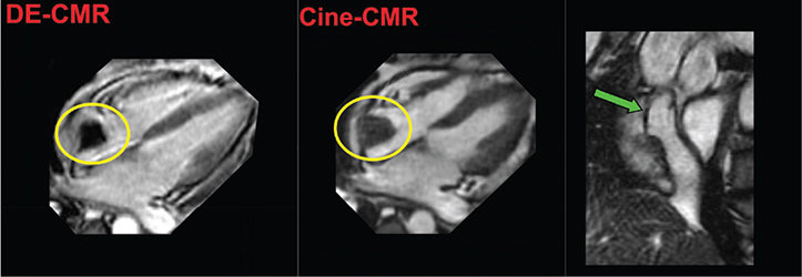 Figure 4.