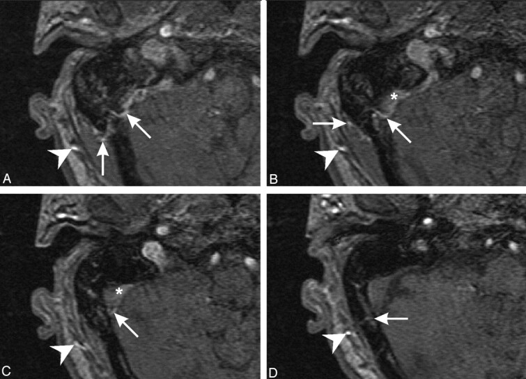 Fig 3.