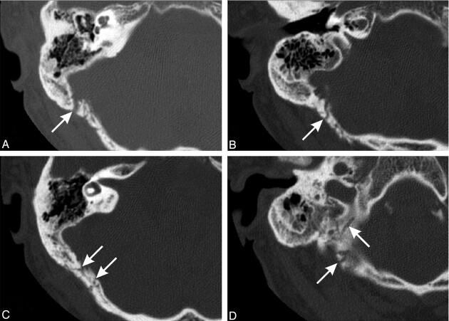 Fig 2.