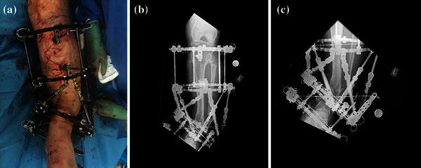 Fig. 10