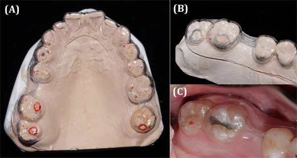 Figura 4