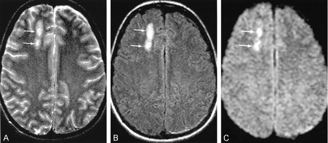 Fig 2.