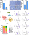 Figure 6. HSF1 Functionally regulates the amount of CD8+ T cells in breast tumors. A, 4T1 cells (5 × 104 cells) with (n = 5) or without (n = 5) HSF1 knockdown were grown orthotopically in Balb/c mice for 3 weeks. Tumor volume at the conclusion of the study is graphed. B, IHC was performed on tumors from A detecting CD8A to identify CD8+ T cells. C, CD8+ T cells from B were quantified for control and HSF1 knockdown tumors by manual counting positive cells in >5 fields of the tumor tissue area. D–F, shCTL and shHSF1 tumors from A were subjected to scRNA-seq. Processed reads were used to map cell clusters for both samples using Seurat 4.2.0. The Uniform Manifold Approximation and Projection (UMAP) integrating both samples is shown in D. These cell types were annotated using expression of specific marker genes for each population, for which a sample of these marker genes is shown in E. The proportion of each cell population was also calculated and graphed in F.