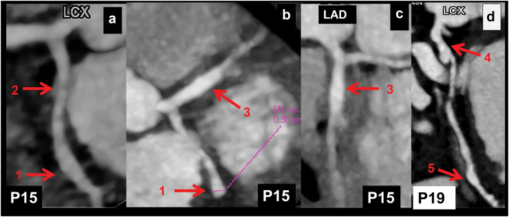 Fig. 3