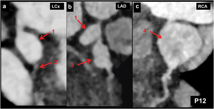 Fig. 6