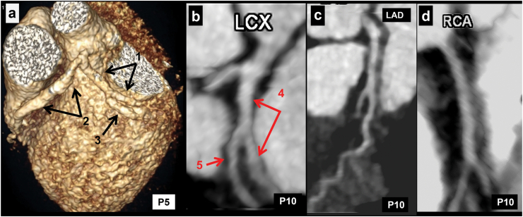 Fig. 4