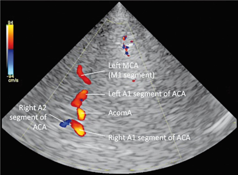 Figure 2