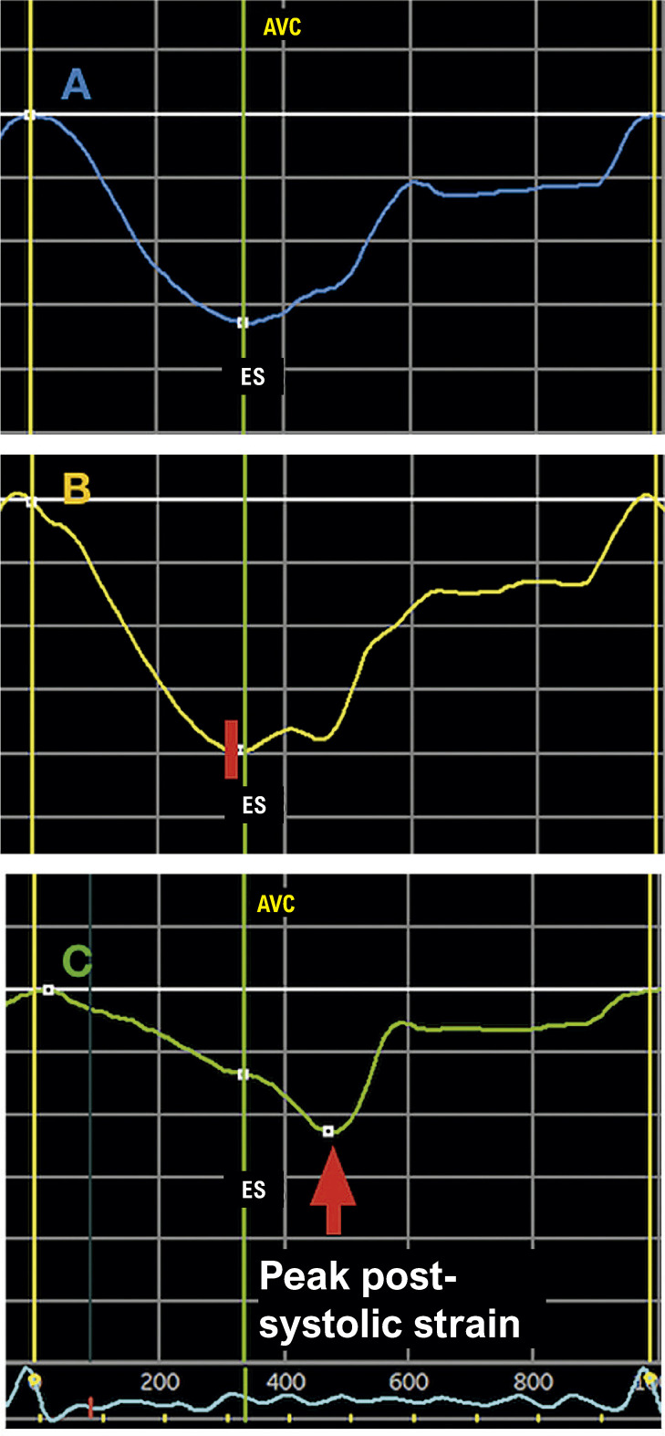 Figure 1.2