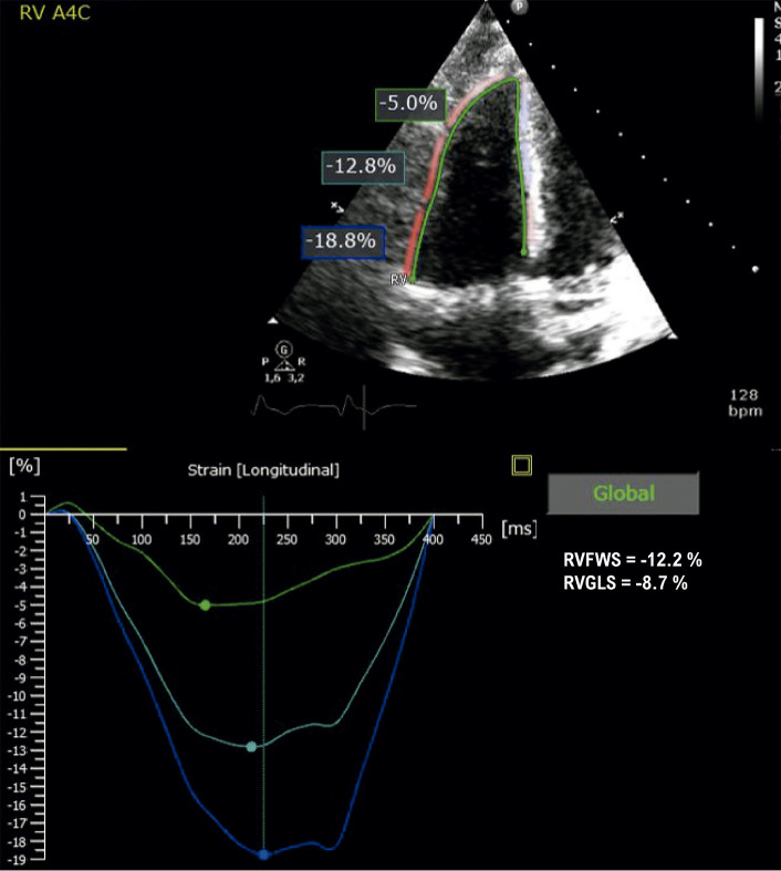 Figure 13.4