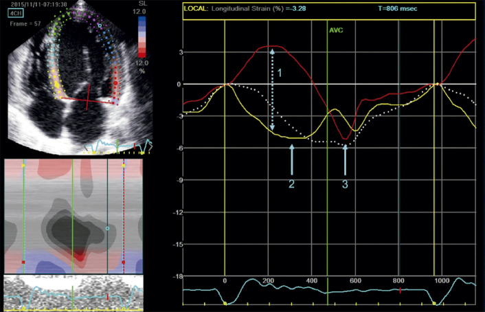 Figure 16.2