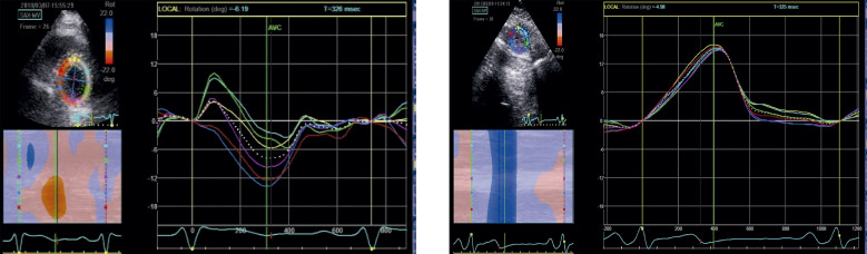 Figure 15.3