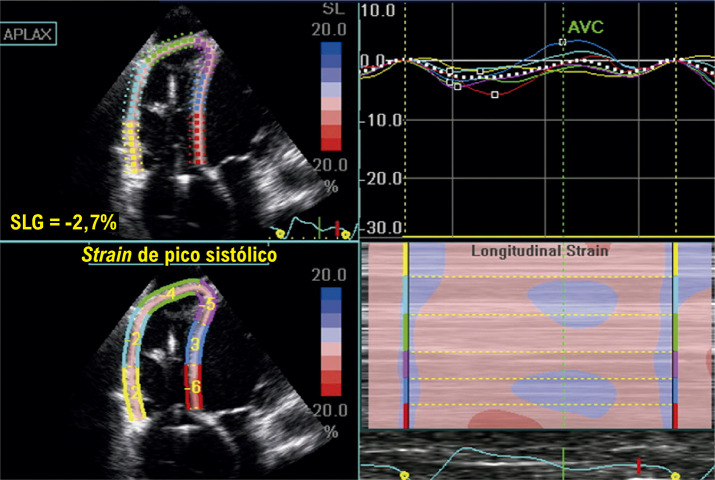 Figura 13.3