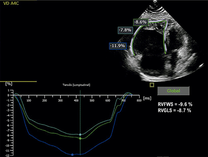 Figure 13.2