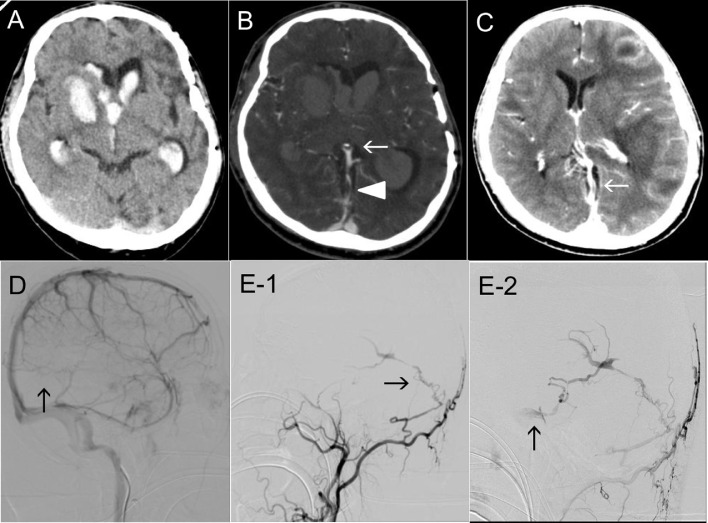 Fig 1