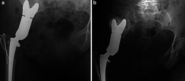 Fig. 1a–b