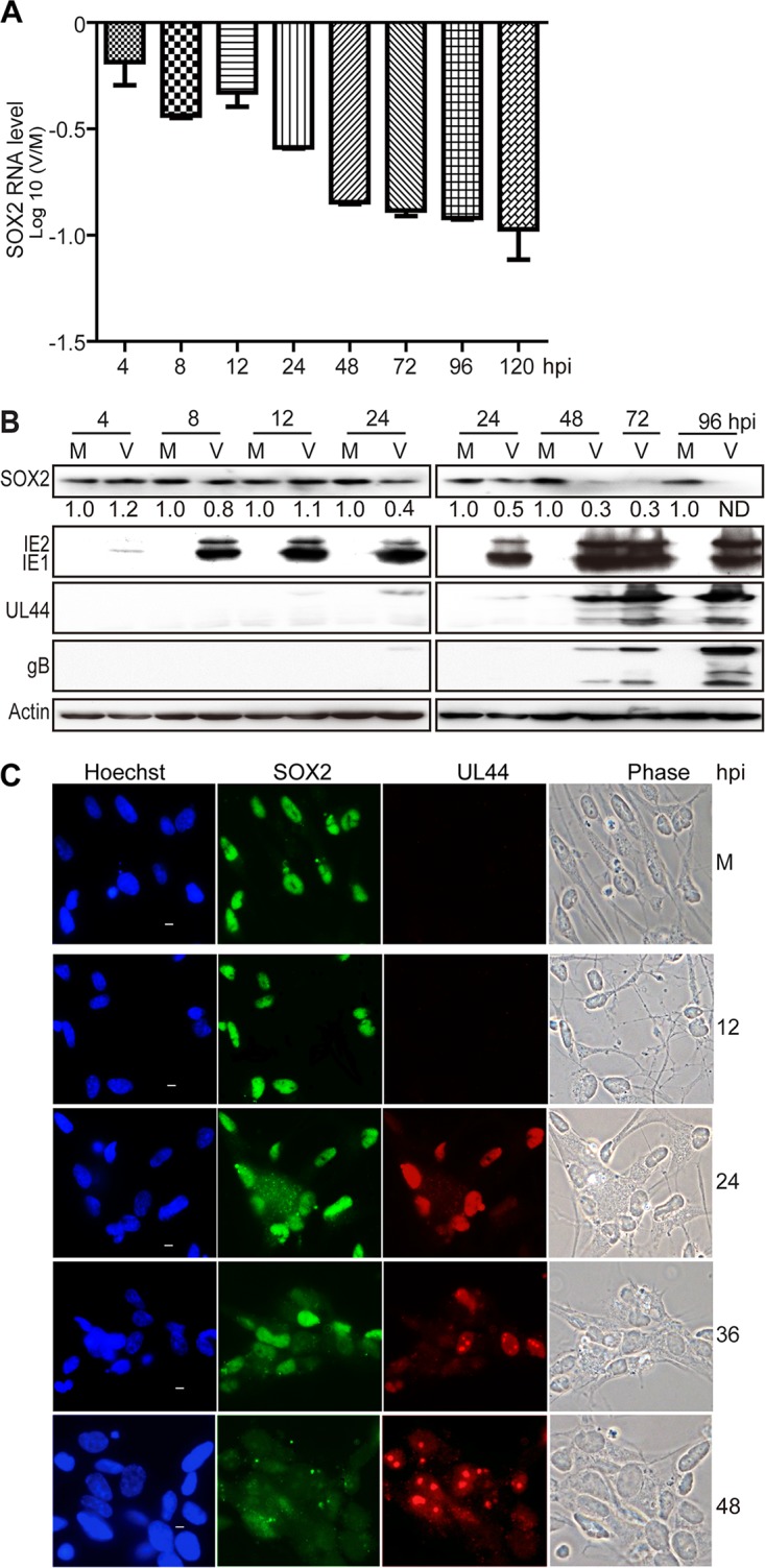 FIG 1