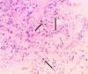 Figure 1b