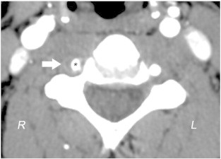 Fig 1