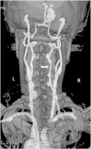 Fig 4