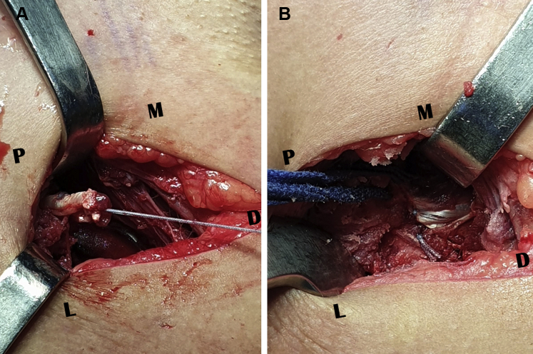 Fig 6