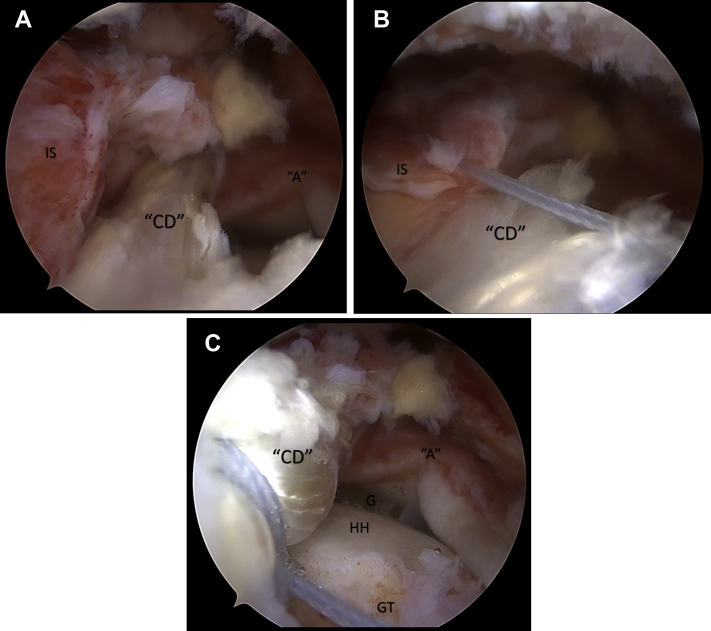 Fig 12