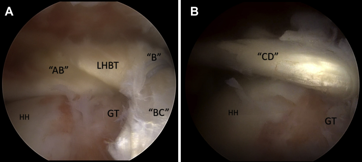 Fig 10