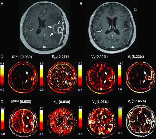 Fig 3.