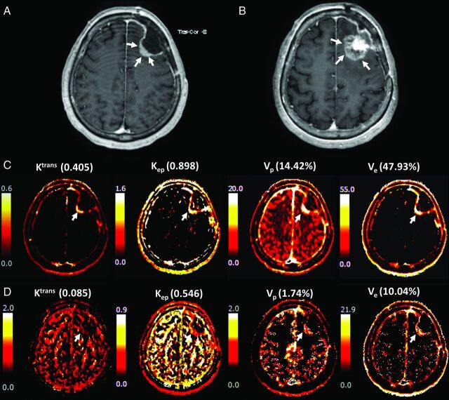 Fig 2.