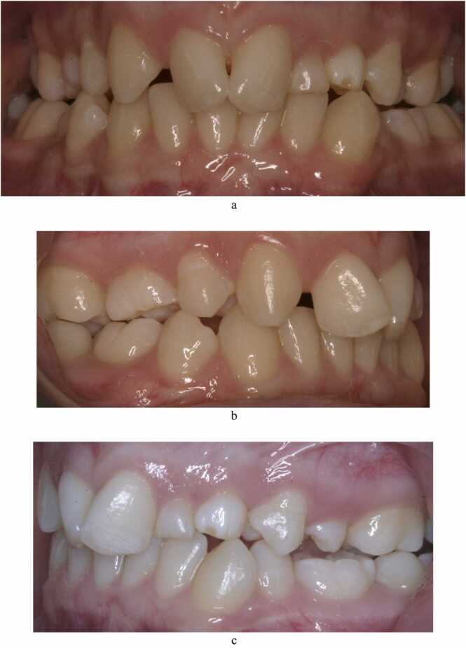 Fig. 2