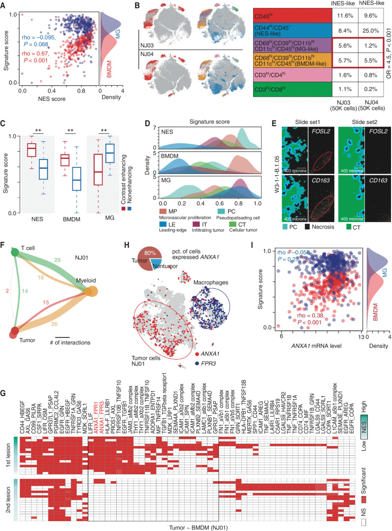 Figure 4. Associations between NES and immune microenvironment. A, Correlation between NES score (x-axis) and signature scores (y-axis) of MGs (blue points) and BMDMs (red points) in TCGA IDH wild-type GBMs. The density plot on the right represents the distribution of MG and BMDM signature scores. B, Left, distribution of CD45 overlaid on the 2D t-distributed stochastic neighbor embedding (t-SNE) plot of the GBM sample derived from NJ03 (top) and NJ04 (bottom) patients. Distribution of combination of gene markers overlaid on the 2D t-SNE plot of GBM samples derived from NJ03 (top) and NJ04 (bottom) patients. Right, comparison of percentages of indicated cell types between two samples (NJ03 and NJ04). OR, odds ratio. C, Comparison of indicated signature scores between samples in contrast-enhancing and nonenhancing regions. Wilcoxon rank-sum test; **, P < 0.01. D, The distribution of indicated signatures (top: NES; middle: BMDM; bottom: MG) among different GBM regions. E, Image of in situ hybridization and tumor feature annotation (derived from IVY GAP, W3-1-1-B.1.05) for FOSL2 and CD163 expression among different regions (top: PC; bottom: CT). F, Interaction among different cell types. The width of links represents the number of significant ligand–receptor interactions between the indicated cell types. G, A heat map for ligand–receptor interactions between indicated cell types across the first and second lesions of NJ01. NS, not significant. H, Distribution of the indicated genes (ANXA1 and FPR3) overlaid on the 2D t-SNE plot of the first lesion of NJ01. The pie plot demonstrates the percentage of the indicated cells highly expressing ANXA1. I, Correlation between ANXA1 mRNA expression (x-axis) and MG (blue) and BMDM (red) signature scores across TCGA IDH wild-type GBMs.