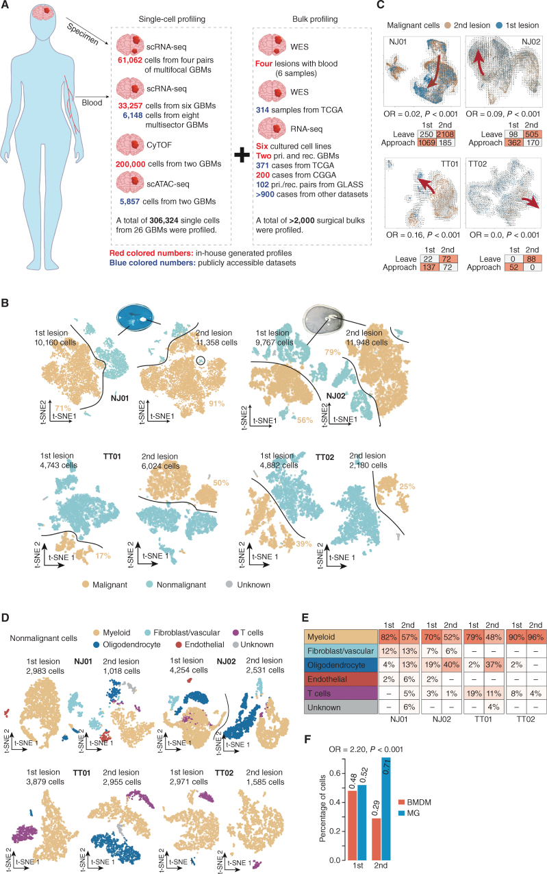 Figure 1. Comparative characterization of multifocal GBMs and TME by scRNA-seq. A, Schematic workflow for the construction of single-cell multifocal GBM transcriptomes. B, t-SNE plot of malignant (orange dots) and nonmalignant (blue dots) cells in the first and second lesions derived from the indicated cases. C, Top, RNA velocity illustrates the direction of tumor cell transition in the t-SNE plot between two lesions across the indicated cases. Bottom, the table shows the number of cells with a putative transition tendency to the center of each lesion. OR indicates odds ratio. D, t-SNE plot of nonmalignant cells in the first and second lesions derived from the indicated cases. E, Comparison of the percentages of different nonmalignant cell types between the first and second lesions across the indicated cases. F, Comparison of percentages of cells identified as BMDMs and MGs in the first and second lesions across the four cases (NJ01, NJ02, TT01, and TT02). OR indicates odds ratio.