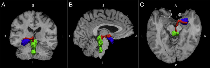 Fig. 1.