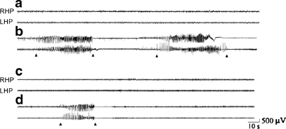 FIG. 1